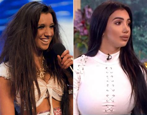 chloe khan before|chloe khan before and after photos.